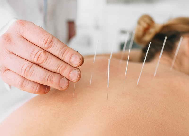 Como a acupuntura pode auxiliar no tratamento de dores articulares
