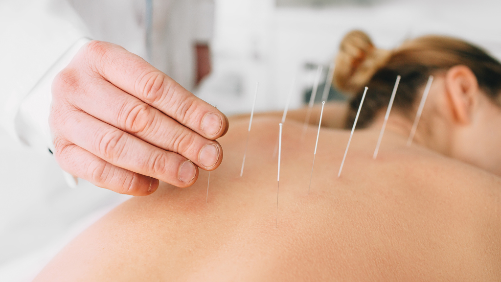 Como a acupuntura pode auxiliar no tratamento de dores articulares
